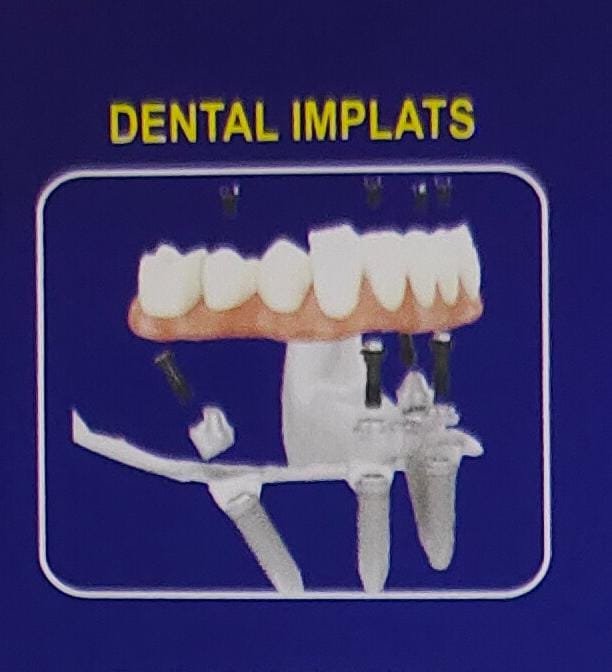 Maxillary Prognathism Treatment